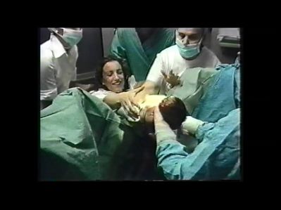 Parto Natural con Noesiterapia bebé recién nacido