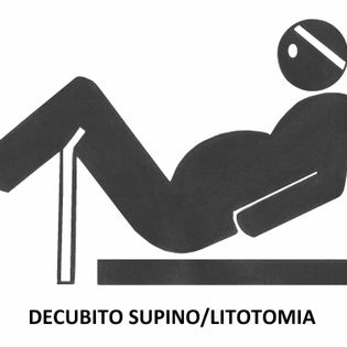 decubito lateral