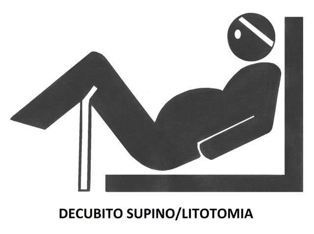 decubito lateral