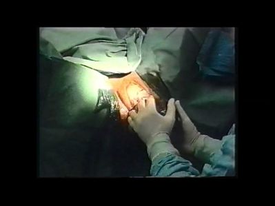 Parto Natural con Noesiterapia expulsivo