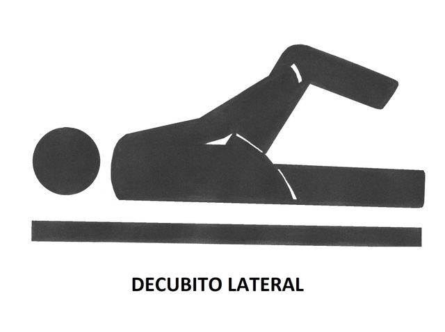 decúbito lateral